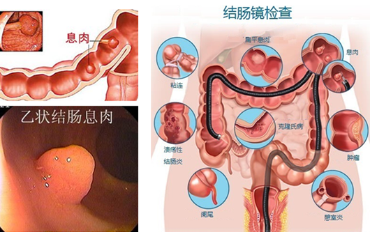 厦门胃病经常发作吃药有用吗