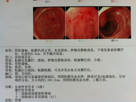 厦门治疗十二指肠溃疡去哪家医院