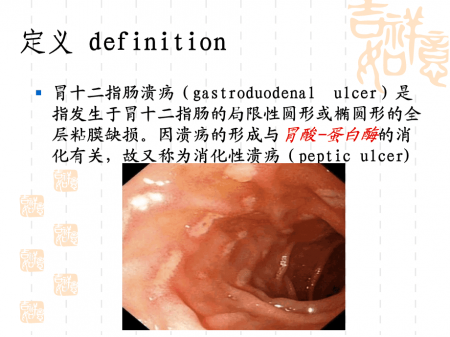 厦门治疗十二指肠溃疡去哪家医院